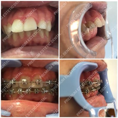 ortodontie-3